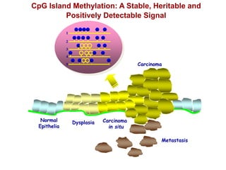 Normal
Epithelia
Dysplasia Carcinoma
in situ
Carcinoma
Metastasis
1
2
3
4
5
CpG Island Methylation: A Stable, Heritable and
Positively Detectable Signal
 