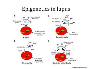 Epigenetics in lupus
Thabet J Autoimmunol 12
 