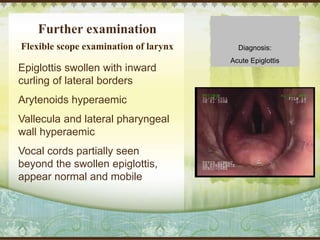 Further examination
Epiglottis swollen with inward
curling of lateral borders
Arytenoids hyperaemic
Vallecula and lateral pharyngeal
wall hyperaemic
Vocal cords partially seen
beyond the swollen epiglottis,
appear normal and mobile
Flexible scope examination of larynx Diagnosis:
Acute Epiglottis
 