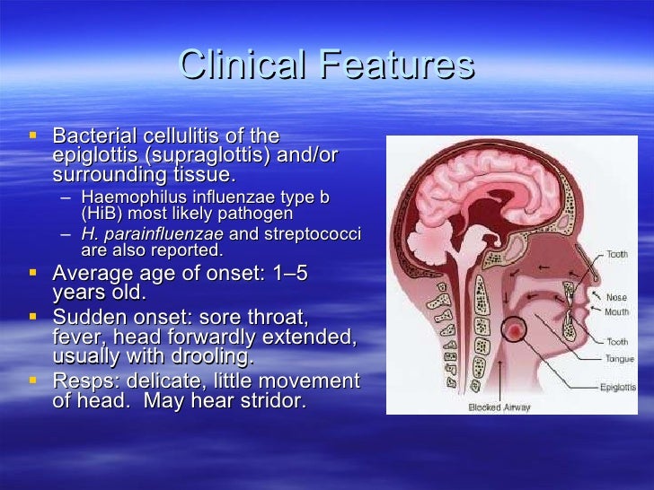 Pathophysiology Of Epiglottitis