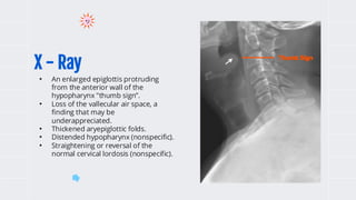 X - Ray
• An enlarged epiglottis protruding
from the anterior wall of the
hypopharynx "thumb sign”.
• Loss of the vallecular air space, a
finding that may be
underappreciated.
• Thickened aryepiglottic folds.
• Distended hypopharynx (nonspecific).
• Straightening or reversal of the
normal cervical lordosis (nonspecific).
Thumb Sign
 