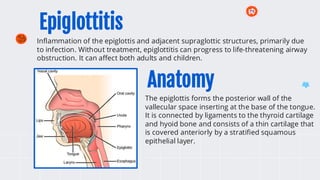 Epiglottitis
Inflammation of the epiglottis and adjacent supraglottic structures, primarily due
to infection. Without treatment, epiglottitis can progress to life-threatening airway
obstruction. It can affect both adults and children.
The epiglottis forms the posterior wall of the
vallecular space inserting at the base of the tongue.
It is connected by ligaments to the thyroid cartilage
and hyoid bone and consists of a thin cartilage that
is covered anteriorly by a stratified squamous
epithelial layer.
Anatomy
 
