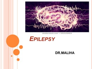 EPILEPSY
DR.MALIHA
 