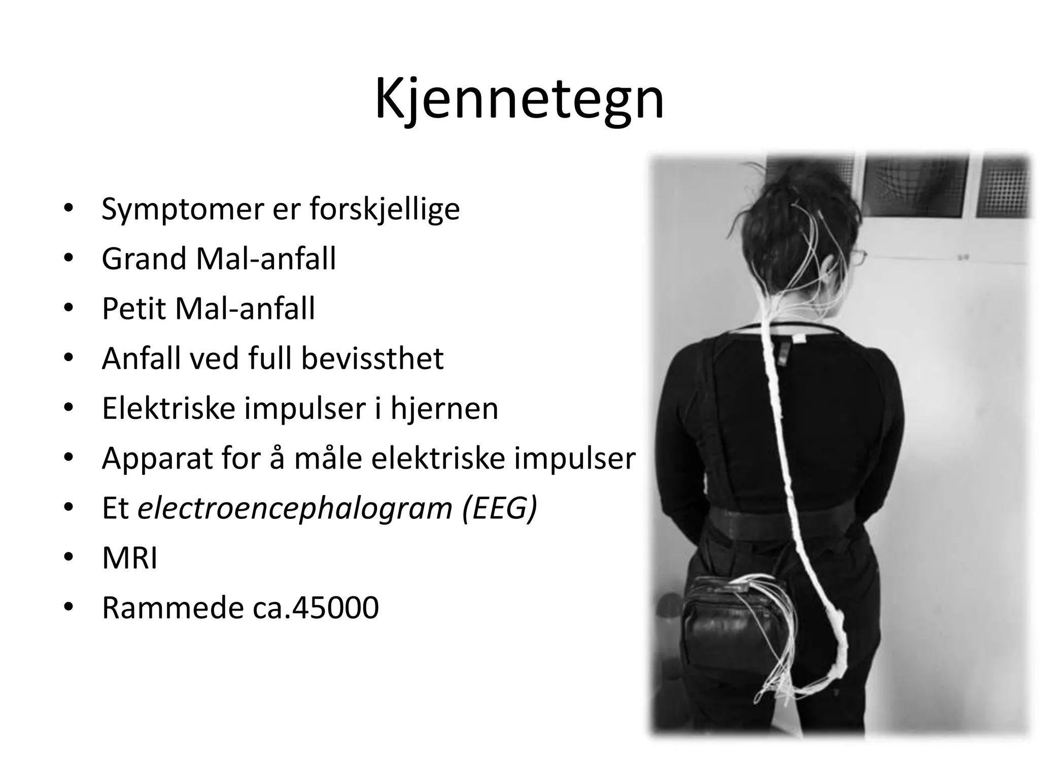 KjennetegnSymptomer er forskjelligeGrand Mal-anfallPetit Mal-anfallAnfall ved full bevissthetElektriske impulser i hjernenApparat for å måle elektriske impulserEt electroencephalogram (EEG)MRIRammede ca.45000