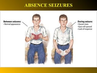 Epilepsi | PPT