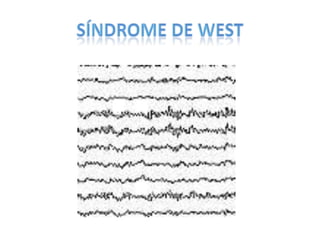 CPHAP 022 Crisis Febriles & Status Epileptico
