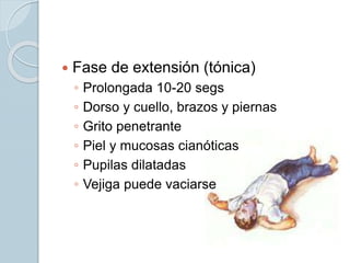  Fase de extensión (tónica)
◦ Prolongada 10-20 segs
◦ Dorso y cuello, brazos y piernas
◦ Grito penetrante
◦ Piel y mucosas cianóticas
◦ Pupilas dilatadas
◦ Vejiga puede vaciarse
 