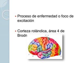  Proceso de enfermedad o foco de
excitación
 Corteza rolándica, área 4 de
Brodmann
 