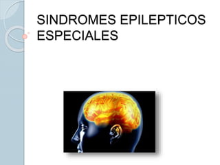 SINDROMES EPILEPTICOS
ESPECIALES
 