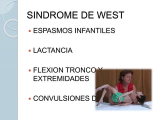  ESPASMOS INFANTILES
 LACTANCIA
 FLEXION TRONCO Y
EXTREMIDADES
 CONVULSIONES DE SALUDO
SINDROME DE WEST
 