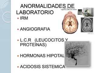  IRM
 ANGIOGRAFIA
 L.C.R (LEUCOCITOS Y
PROTEINAS)
 HORMONAS HIPOTALAMICAS
 ACIDOSIS SISTEMICA
ANORMALIDADES DE
LABORATORIO
 