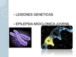  LESIONES GENETICAS
 EPILEPSIA MIOCLONICA JUVENIL
 
