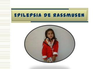 Crisis Parciales ComplejasDuración 90-200 segInicio focal frecuenteAutomatismos complejosEmisión de sonidos guturales/incoherentesConfusión post ictalEdad adulta