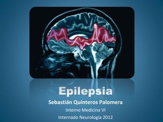 Epilepsia Sebastián Quinteros Palomera Interno Medicina VI Internado Neurología 2012 