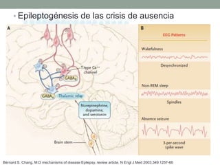 • Epileptogénesis de las crisis de ausencia
Bernard S. Chang, M.D mechanisms of disease Epilepsy, review article, N Engl J Med 2003;349:1257-66
 