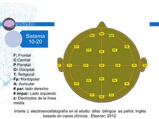 Sistema
10-20
Irriarte J. electroencefalografía en el adulto: atlas bilingüe es pañol. Inglés
basado en casos clínicos. Elsevier; 2012
F: Frontal
C:Central
P:Parietal
O: Occipital
T: Temporal
Fp: frontopolar
A: Auricular
# par: lado derecho
# impar: Lado izquierdo
z: Electrodos de la línea
media
 