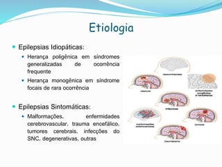 Etiologia
 Epilepsias Idiopáticas:
 Herança poligênica em síndromes
generalizadas de ocorrência
frequente
 Herança monogênica em síndrome
focais de rara ocorrência
 Epilepsias Sintomáticas:
 Malformações, enfermidades
cerebrovascular, trauma encefálico,
tumores cerebrais, infecções do
SNC, degenerativas, outras
 