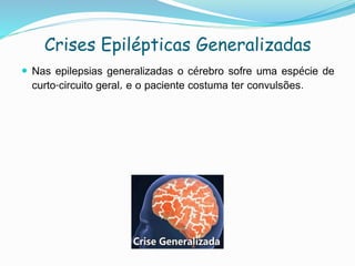 Crises Epilépticas Generalizadas
 Nas epilepsias generalizadas o cérebro sofre uma espécie de
curto-circuito geral, e o paciente costuma ter convulsões.
 