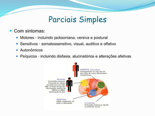 Parciais Simples
 Com sintomas:
 Motores - incluindo jacksoniana, versiva e postural
 Sensitivos - somatossensitivo, visual, auditivo e olfativo
 Autonômicos
 Psíquicos - incluindo disfasia, alucinatórios e alterações afetivas
 