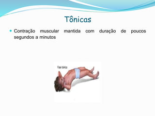 Tônicas
 Contração muscular mantida com duração de poucos
segundos a minutos
 