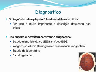 Diagnóstico
 O diagnóstico de epilepsia é fundamentalmente clínico
 Por isso é muito importante a descrição detalhada das
crises
 Dão suporte e permitem confirmar o diagnóstico:
 Estudo eletrofisiológico (EEG e vídeo-EEG)
 Imagens cerebrais (tomografia e ressonância magnética)
 Estudo de laboratório
 Estudo genético
 