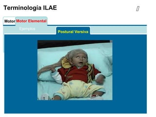 Motor Motor Elemental
Contracción de un músculo o grupo muscular generalmente estereotipado y que
no se descompone en distintas fases.
Tónico-clónico corresponde a una secuencia motora elemental
Terminología ILAE
Postural Versiva

Ejemplos
 