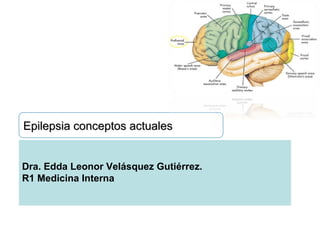 Epilepsia conceptos actualesEpilepsia conceptos actuales
Dra. Edda Leonor Velásquez Gutiérrez.
R1 Medicina Interna
 