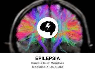 EPILEPSIA
Daniela Ruiz Mendoza
Medicina X-Unisucre
 