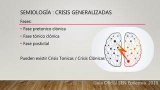 SEMIOLOGÍA : CRISIS GENERALIZADAS
Fases:
• Fase pretonico clónica
• Fase tónico clónica
• Fase postictal
Pueden existir Crisis Tonicas / Crisis Clónicas
Guia Oficial SEN Epilepsia. 2010.
 