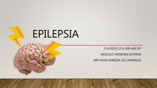 EPILEPSIA
C.H ISSSTE 25 A 300-400 25ª
MODULO: MEDICINA INTERNA
MIP HUGO ENRIQUE ZILLI MORALES
 