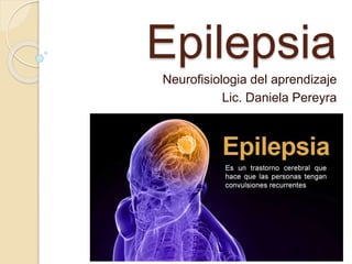 Epilepsia
Neurofisiologia del aprendizaje
Lic. Daniela Pereyra
 