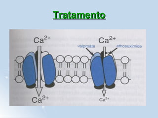 Tratamento 