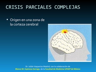 CRISIS PARCIALES COMPLEJAS Origen en una zona de la corteza cerebral Dr. Julián Vaquerizo-Madrid, con la colaboración de Blanca M. Espinosa Zarraga , de la  Facultad de Medicina UPAEP de México 