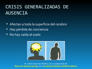 CRISIS GENERALIZADAS DE AUSENCIA Afectan a toda la superficie del cerebro  Hay pérdida de conciencia No hay caída al suelo Dr. Julián Vaquerizo-Madrid, con la colaboración de Blanca M. Espinosa Zarraga , de la  Facultad de Medicina UPAEP de México 
