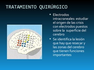 TRATAMIENTO QUIRÚRGICO Electrodos intracraneales: estudiar el origen de las crisis con electrodos puestos sobre la  superficie del cerebro Se identifica la lesión que hay que resecar y las zonas del cerebro que tienen funciones importantes 