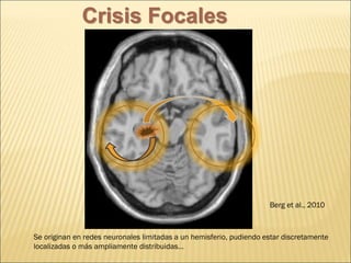 Se originan en redes neuronales limitadas a un hemisferio, pudiendo estar discretamente
localizadas o más ampliamente distribuidas…
Berg et al., 2010
Crisis Focales
 