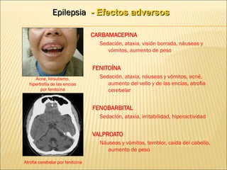 Epilepsia - Efectos adversos
CARBAMACEPINA
Sedación, ataxia, visión borrada, náuseas y
vómitos, aumento de peso
FENITOÍNA
Sedación, ataxia, náuseas y vómitos, acné,
aumento del vello y de las encías, atrofia
cerebelar
FENOBARBITAL
Sedación, ataxia, irritabilidad, hiperactividad
VALPROATO
Náuseas y vómitos, temblor, caída del cabello,
aumento de peso
Acne, hirsutismo,
hipertrofia de las encías
por fenitoína
Atrofia cerebelar por fenitoína
 