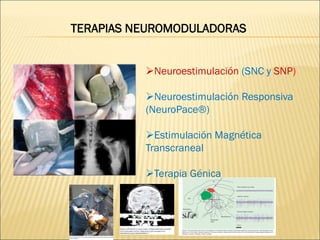 TERAPIAS NEUROMODULADORAS
Neuroestimulación (SNC y SNP)
Neuroestimulación Responsiva
(NeuroPace®)
Estimulación Magnética
Transcraneal
Terapia Génica
 
