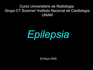 Epilepsia 20 Mayo 2009   Curso Universitario de Radiología  Grupo CT Scanner/ Instituto Nacional de Cardiología UNAM 