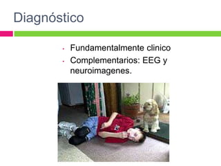 Diagnóstico

       •   Fundamentalmente clinico
       •   Complementarios: EEG y
           neuroimagenes.
 