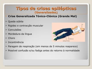 Tipos de crises epilépticas  (Generalizadas) Crise Generalizada Tónico-Clónica (Grande Mal) Queda súbita  Rigidez e contracção muscular Convulsões  Mordedura da língua Choro  Incontinência  Paragem de respiração (em menos de 5 minutos reaparece)  Possível confusão e/ou fadiga antes do retorno à normalidade 