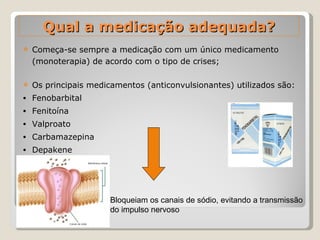 Começa-se sempre a medicação com um único medicamento (monoterapia) de acordo com o tipo de crises; Os principais medicamentos (anticonvulsionantes) utilizados são: Fenobarbital  Fenitoína Valproato Carbamazepina Depakene Qual a medicação adequada? Bloqueiam os canais de sódio, evitando a transmissão do impulso nervoso 
