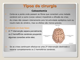Calosotomia  Corta-se a ponte onde passam as fibras que conectam uma metade cerebral com a outra (corpo caloso) impedindo a difusão da crise; As crises não cessam inteiramente pois há actividade epiléptica num ou noutro lado do cérebro, mas os efeitos são menos graves; Se as crises continuam efectua-se uma 2ª intervenção destinada a separar completamente os 2 hemisférios cerebrais. Tipos de cirurgia É praticada em duas fases: A 1ª intervenção separa parcialmente os 2 hemisférios cerebrais poupando algumas conexões entre eles; 
