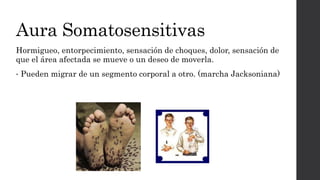 Aura Somatosensitivas
Hormigueo, entorpecimiento, sensación de choques, dolor, sensación de
que el área afectada se mueve o un deseo de moverla.
• Pueden migrar de un segmento corporal a otro. (marcha Jacksoniana)
 