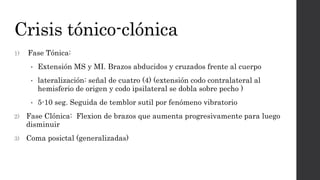 Crisis tónico-clónica
1) Fase Tónica:
• Extensión MS y MI. Brazos abducidos y cruzados frente al cuerpo
• lateralización: señal de cuatro (4) (extensión codo contralateral al
hemisferio de origen y codo ipsilateral se dobla sobre pecho )
• 5-10 seg. Seguida de temblor sutil por fenómeno vibratorio
2) Fase Clónica: Flexion de brazos que aumenta progresivamente para luego
disminuir
3) Coma posictal (generalizadas)
 