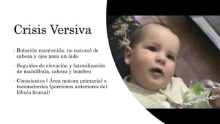 Crisis Versiva
• Rotación mantenida, no natural de
cabeza y ojos para un lado
• Seguidos de elevación y lateralización
de mandíbula, cabeza y hombro
• Conscientes ( Área motora primaria) o
inconscientes (porciones anteriores del
lóbulo frontal)
 