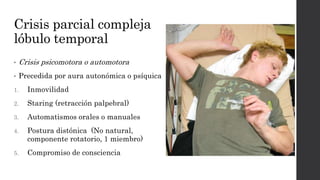 Crisis parcial compleja
lóbulo temporal
• Crisis psicomotora o automotora
• Precedida por aura autonómica o psíquica
1. Inmovilidad
2. Staring (retracción palpebral)
3. Automatismos orales o manuales
4. Postura distónica (No natural,
componente rotatorio, 1 miembro)
5. Compromiso de consciencia
 