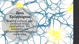 Zona
Epileptógena
• Región cortical que
produce crisis
epilépticas. En
contacto con
numerosas estructuras
corticales
 