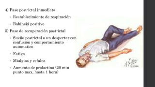 4) Fase post-ictal inmediata
• Restablecimiento de respiración
• Babinski positivo
5) Fase de recuperación post-ictal
• Sueño post-ictal o un despertar con
confusión y comportamiento
automatico
• Fatiga
• Mialgias y cefalea
• Aumento de prolactina (20 min
punto max, hasta 1 hora)
 