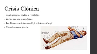 Crisis Clónica
• Contracciones cortas y repetidas
• Varios grupos musculares
• Temblores con intevalos (0,2 – 0,5 veces/seg)
• Alteacion consciencia
 